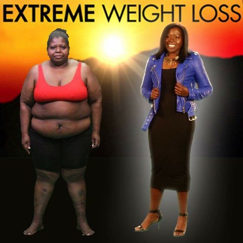 Mitzi White Extreme Weight Loss